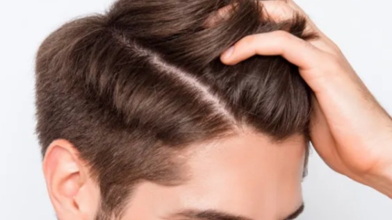 Yağlı Saçlar İçin Bitkisel Bakım Rehberi Yağlı Saçlar İçin Bitkisel Bakım Rehberi