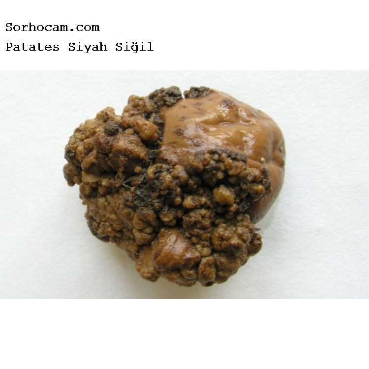 Patates Siyah Siğil Hastalığı (Rhizoctonia Solani) Patates Siyah Siğil Hastalığı (Rhizoctonia Solani)
