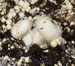 Örümcek Ağı Hastalığı (Islak Kabarcık) Nedir?