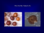 Patates Beyaz Kist Ve Altın Nematodu (Globodera Rostochiensis Wollenw)