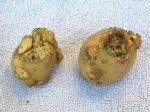 Patates Siğil Hastalığı Belirtileri, Nedenleri Ve Mücadelesi