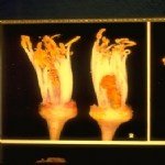 Limon Çiçek Güvesi Nedir? Zararları Ve Mücadele Yöntemleri